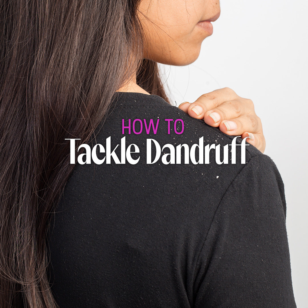 woman in a black shirt examining the dandruff on her shoulder